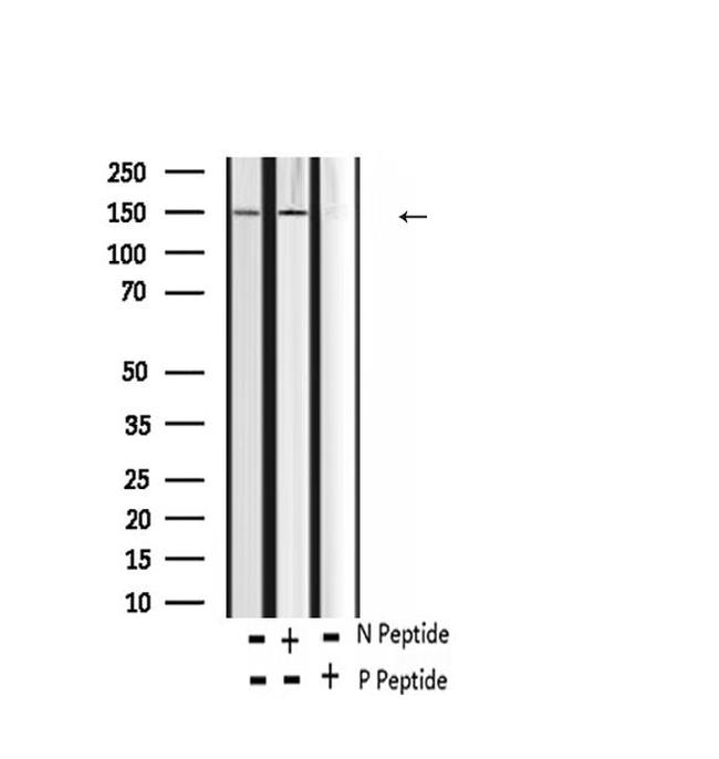 Phospho-FLT3 (Tyr969) Antibody in Western Blot (WB)