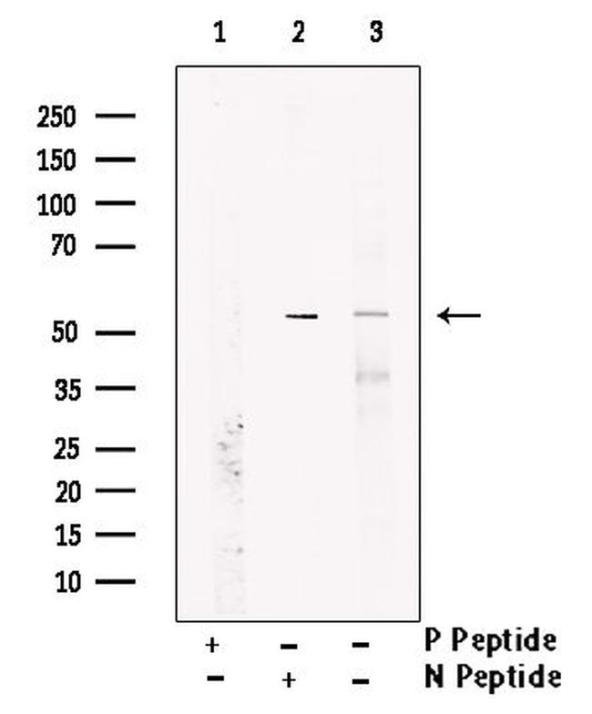 Phospho-MAPKAPK2 (Thr222) Antibody in Western Blot (WB)