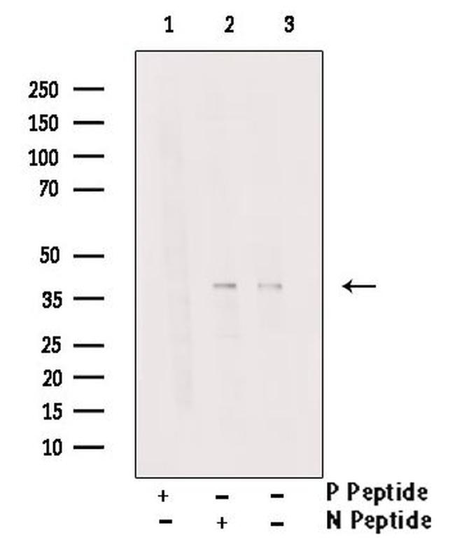 Phospho-NPM1 (Thr95) Antibody in Western Blot (WB)