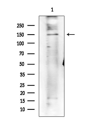 Phospho-SHIP2 (Tyr1135) Antibody in Western Blot (WB)