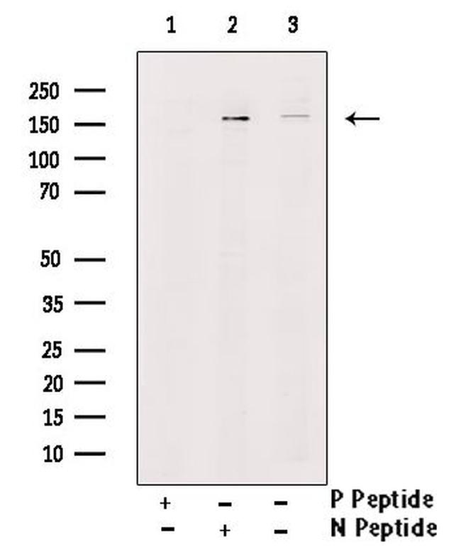 Phospho-SHIP2 (Tyr986, Tyr987) Antibody in Western Blot (WB)