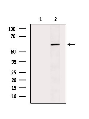 Phospho-SQSTM1 (Thr269, Ser272) Antibody in Western Blot (WB)