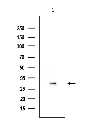 Phospho-CDK6 (Tyr24) Antibody in Western Blot (WB)