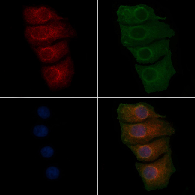 VWF Antibody in Immunocytochemistry (ICC/IF)