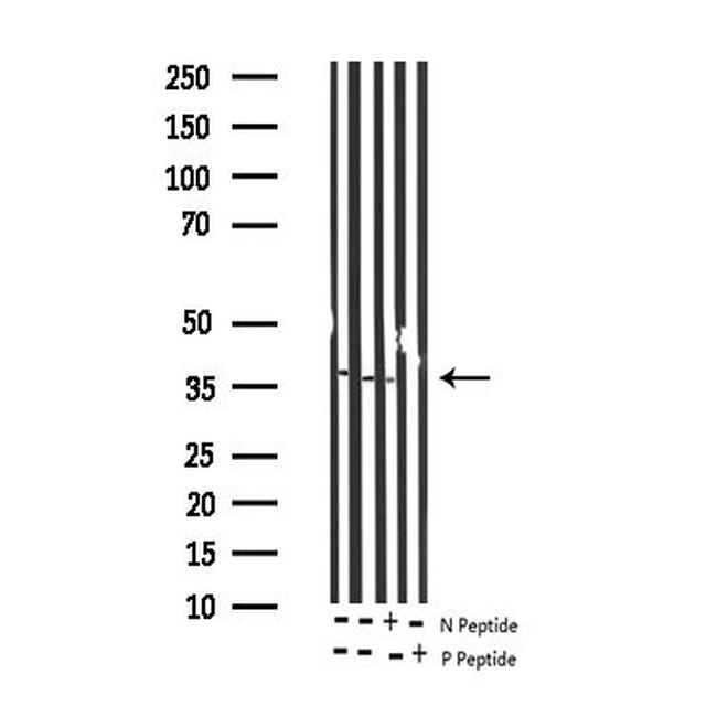 Phospho-IkappaB epsilon (Ser161) Antibody in Western Blot (WB)