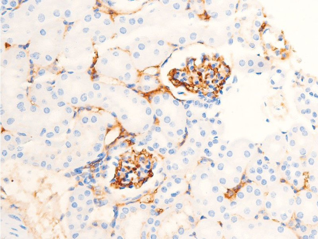 Phospho-Chk1 (Ser286) Antibody in Immunohistochemistry (Paraffin) (IHC (P))