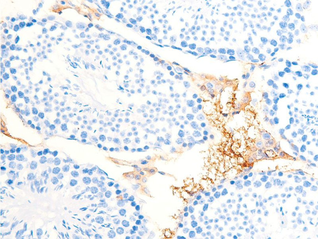 Phospho-Chk1 (Ser286) Antibody in Immunohistochemistry (Paraffin) (IHC (P))