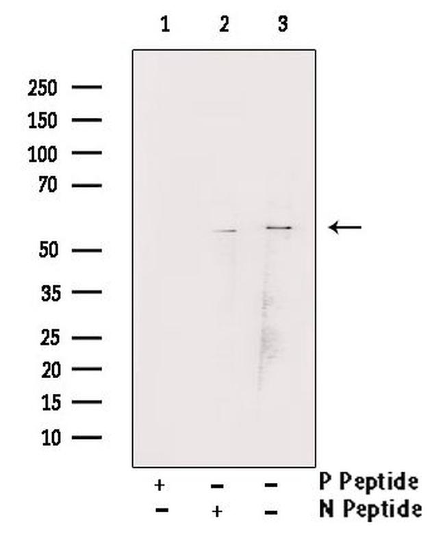 Phospho-Chk1 (Ser345) Antibody in Western Blot (WB)