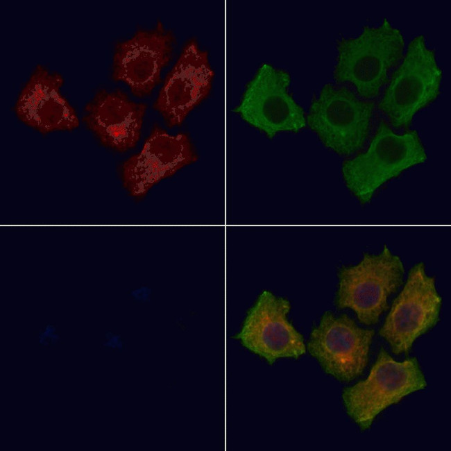 Phospho-EGFR (Tyr1197) Antibody in Immunocytochemistry (ICC/IF)