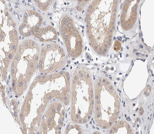 Phospho-Amyloid Precursor Protein (Thr743) Antibody in Immunohistochemistry (Paraffin) (IHC (P))