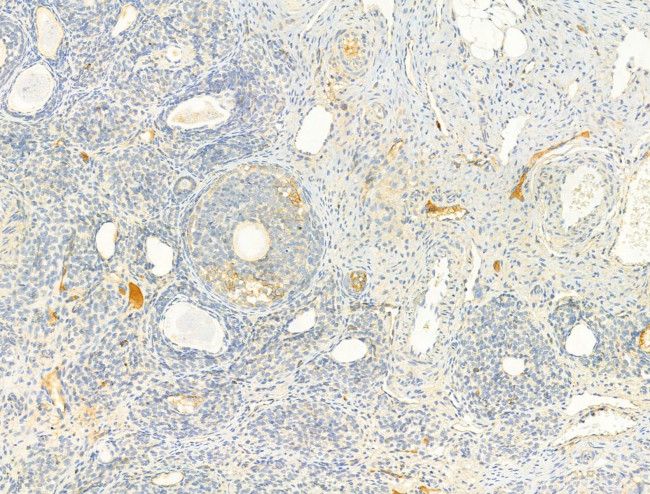 Phospho-Fyn (Tyr531) Antibody in Immunohistochemistry (Paraffin) (IHC (P))