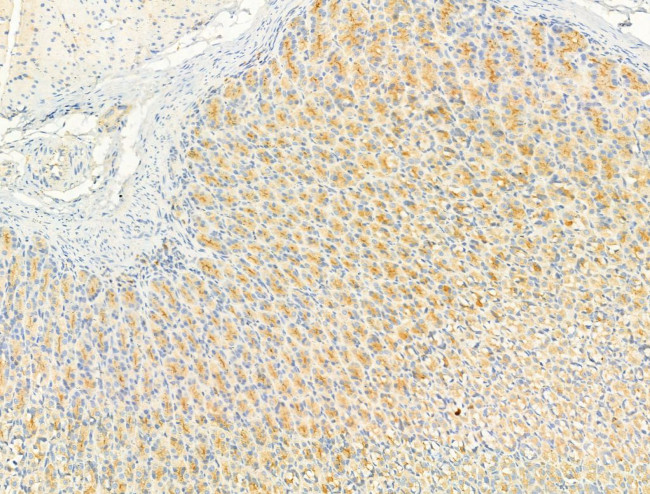 Phospho-Fyn (Tyr531) Antibody in Immunohistochemistry (Paraffin) (IHC (P))