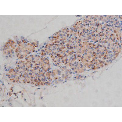 Phospho-Fyn (Tyr531) Antibody in Immunohistochemistry (Paraffin) (IHC (P))