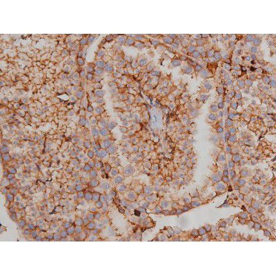 Phospho-Fyn (Tyr531) Antibody in Immunohistochemistry (Paraffin) (IHC (P))