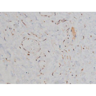 Phospho-Fyn (Tyr531) Antibody in Immunohistochemistry (Paraffin) (IHC (P))