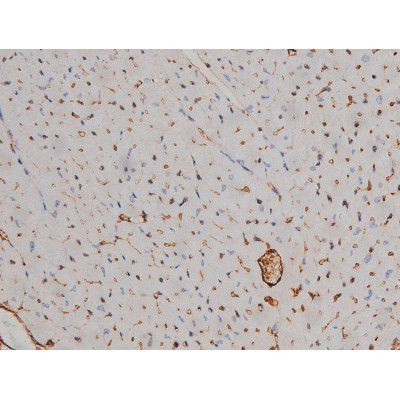 Phospho-Fyn (Tyr531) Antibody in Immunohistochemistry (Paraffin) (IHC (P))