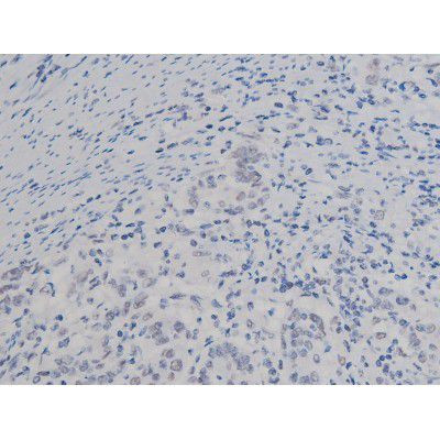 Phospho-NPM1 (Thr199) Antibody in Immunohistochemistry (Paraffin) (IHC (P))