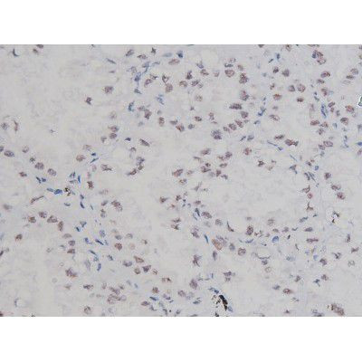 Phospho-NPM1 (Thr199) Antibody in Immunohistochemistry (Paraffin) (IHC (P))