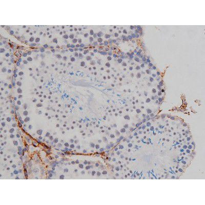 Phospho-NPM1 (Thr199) Antibody in Immunohistochemistry (Paraffin) (IHC (P))