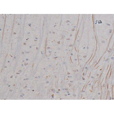 Phospho-NPM1 (Thr199) Antibody in Immunohistochemistry (Paraffin) (IHC (P))