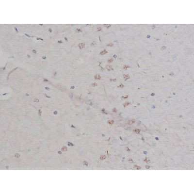 Phospho-NPM1 (Thr199) Antibody in Immunohistochemistry (Paraffin) (IHC (P))