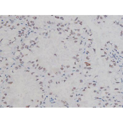 Phospho-NPM1 (Thr199) Antibody in Immunohistochemistry (Paraffin) (IHC (P))