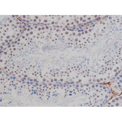 Phospho-NPM1 (Thr199) Antibody in Immunohistochemistry (Paraffin) (IHC (P))