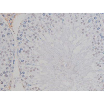 Phospho-NPM1 (Thr199) Antibody in Immunohistochemistry (Paraffin) (IHC (P))