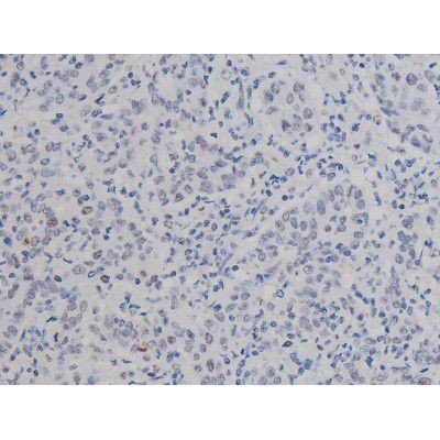 Phospho-NPM1 (Thr199) Antibody in Immunohistochemistry (Paraffin) (IHC (P))