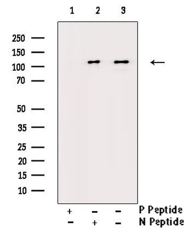 Phospho-CSF1R (Tyr809) Antibody in Western Blot (WB)