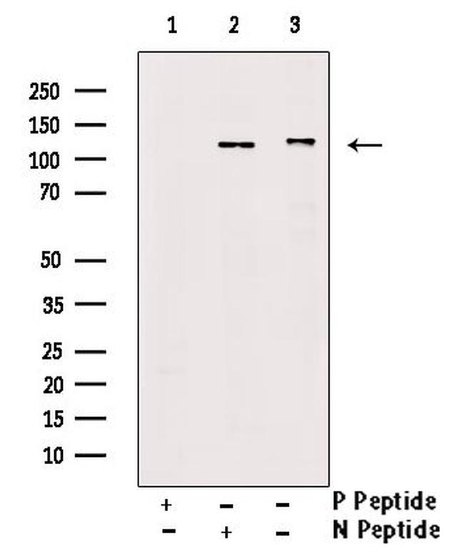 Phospho-PDGFRb (Tyr771) Antibody in Western Blot (WB)