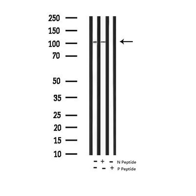 Phospho-Androgen Receptor (Ser651) Antibody in Western Blot (WB)