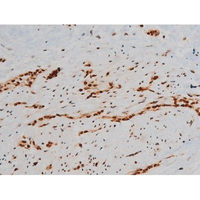 Phospho-Ezrin (Tyr354) Antibody in Immunohistochemistry (Paraffin) (IHC (P))