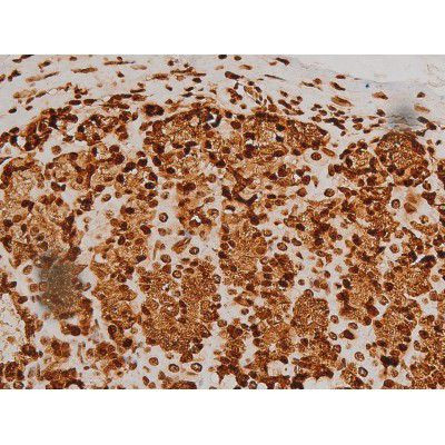 Phospho-Ezrin (Tyr354) Antibody in Immunohistochemistry (Paraffin) (IHC (P))