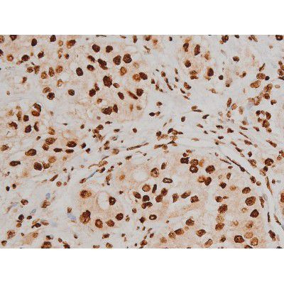 Phospho-Ezrin (Tyr354) Antibody in Immunohistochemistry (Paraffin) (IHC (P))