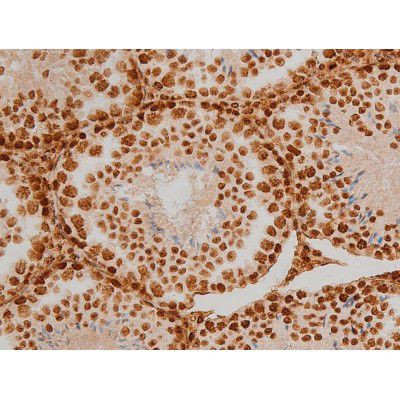 Phospho-Ezrin (Tyr354) Antibody in Immunohistochemistry (Paraffin) (IHC (P))