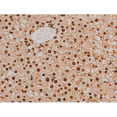 Phospho-Ezrin (Tyr354) Antibody in Immunohistochemistry (Paraffin) (IHC (P))