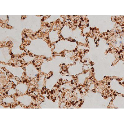 Phospho-Ezrin (Tyr354) Antibody in Immunohistochemistry (Paraffin) (IHC (P))