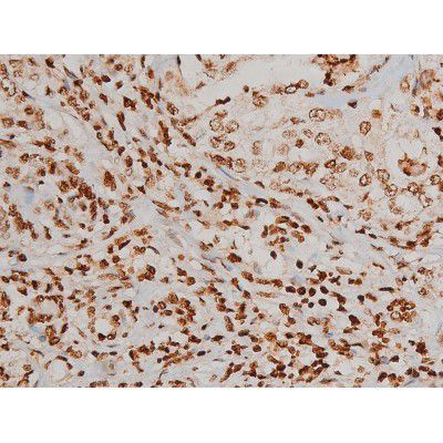 Phospho-Ezrin (Tyr354) Antibody in Immunohistochemistry (Paraffin) (IHC (P))