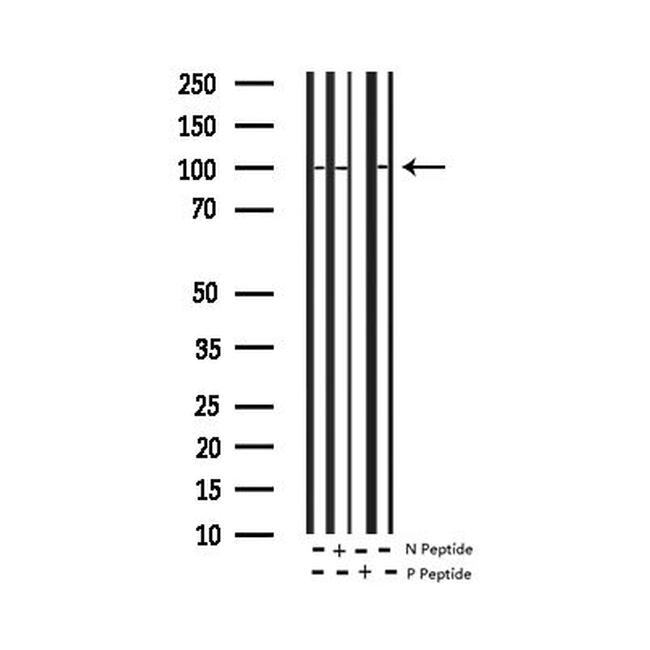 Phospho-NFkB p105 (Ser932) Antibody in Western Blot (WB)