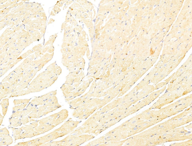 Phospho-p70 S6 Kinase (Thr389, Thr412) Antibody in Immunohistochemistry (Paraffin) (IHC (P))