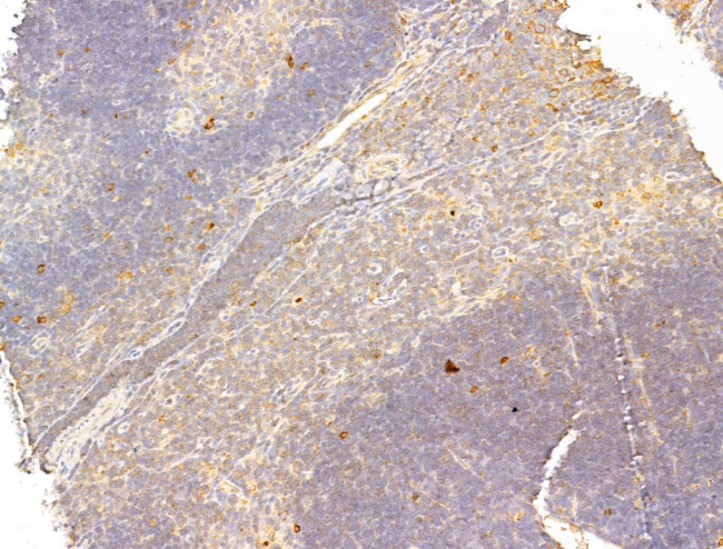 Phospho-p70 S6 Kinase (Thr389, Thr412) Antibody in Immunohistochemistry (Paraffin) (IHC (P))