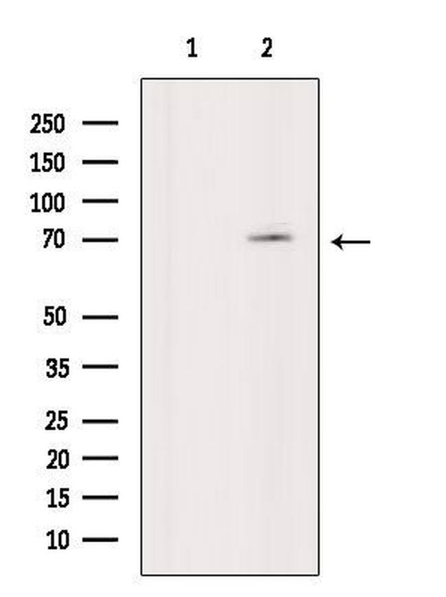 Phospho-p70 S6 Kinase (Thr389, Thr412) Antibody in Western Blot (WB)