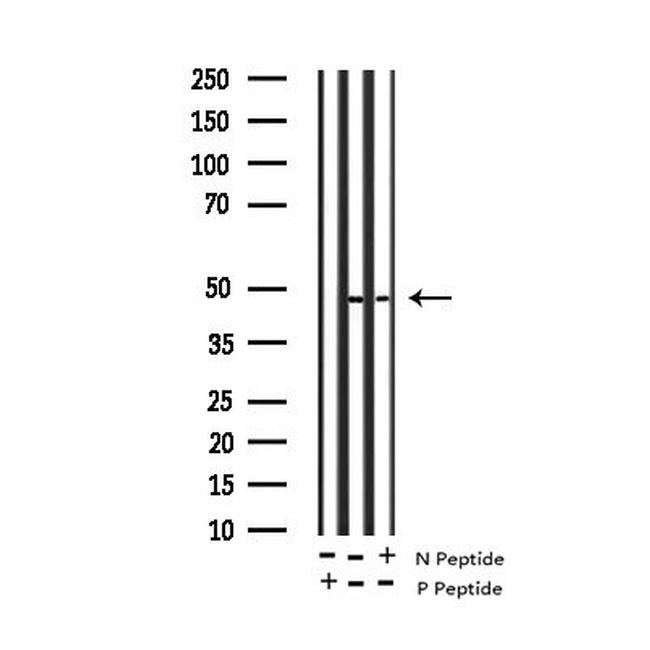 Phospho-CXCR2 (Ser347) Antibody in Western Blot (WB)