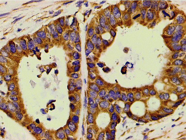 Phospho-PI3K p85 alpha (Tyr607) Antibody in Immunohistochemistry (Paraffin) (IHC (P))