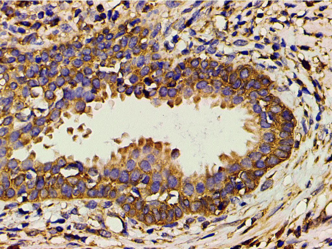 Phospho-PI3K p85 alpha (Tyr607) Antibody in Immunohistochemistry (Paraffin) (IHC (P))