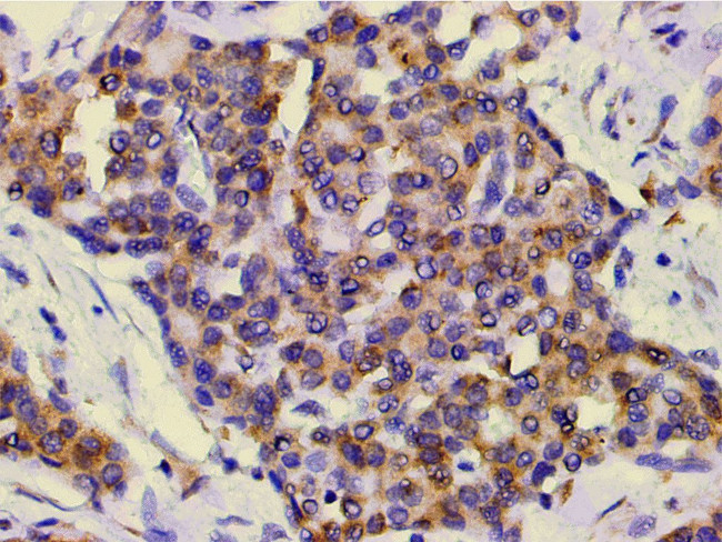 Phospho-PI3K p85 alpha (Tyr607) Antibody in Immunohistochemistry (Paraffin) (IHC (P))