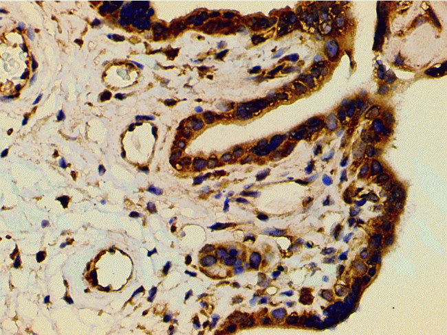 Phospho-PI3K p85 alpha (Tyr607) Antibody in Immunohistochemistry (Paraffin) (IHC (P))