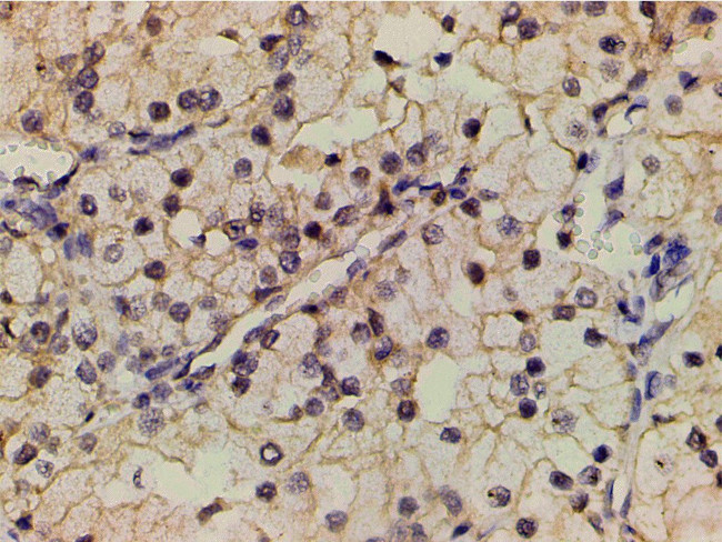 Phospho-PI3K p85 alpha (Tyr607) Antibody in Immunohistochemistry (Paraffin) (IHC (P))