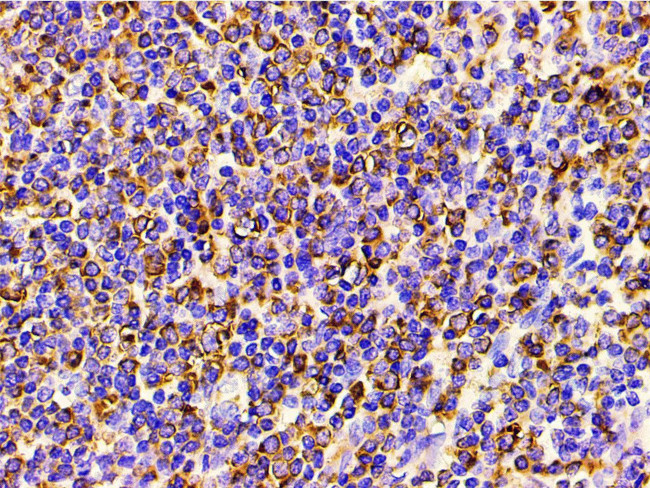 Phospho-PI3K p85 alpha (Tyr607) Antibody in Immunohistochemistry (Paraffin) (IHC (P))